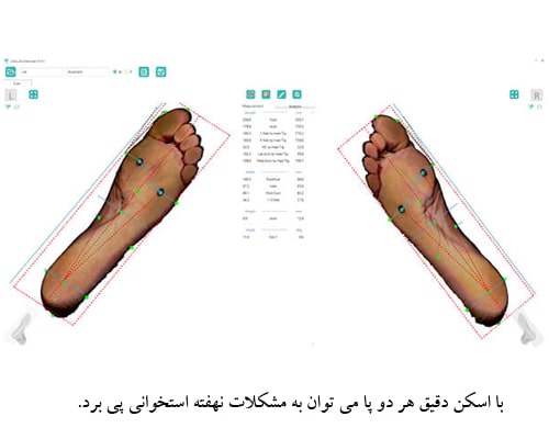 اسکن سه بعدی کف پا