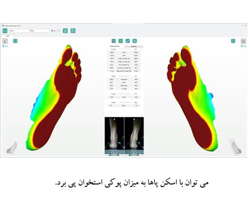 اسکن سه بعدی پا