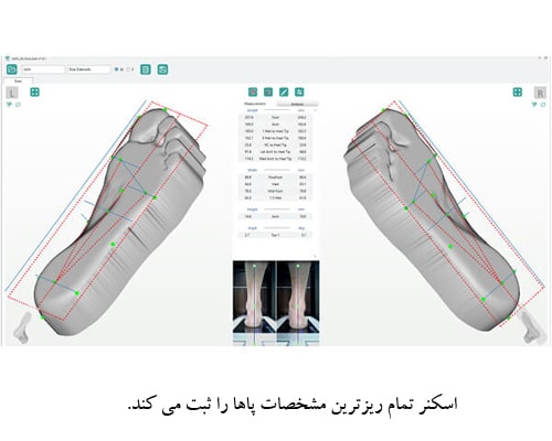 اسکن سه بعدی پا و سفارش کفش ارتوپدی