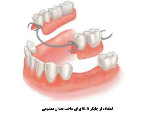 پرینت سه بعدی دندان مصنوعی